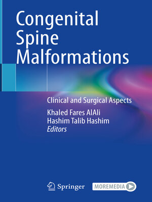 cover image of Congenital Spine Malformations